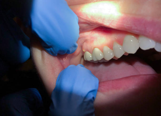 Best Broken or Chipped Tooth Repair in Horicon, WI